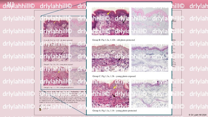 Dr Lylah Hill Histological Research: Young Vs Mature Skin 2